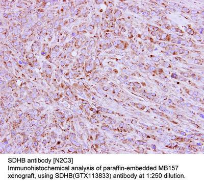 SDHB antibody [N2C3], GeneTex