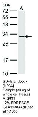 SDHB antibody [N2C3], GeneTex