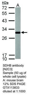 SDHB antibody [N2C3], GeneTex