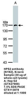 HPS2  antibody [N1N2], N-term, GeneTex