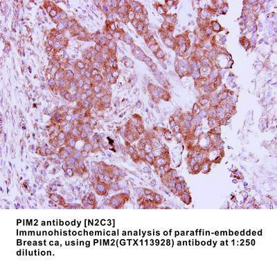 PIM2 antibody [N2C3], GeneTex