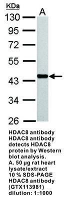 HDAC8 antibody [N3C3], GeneTex