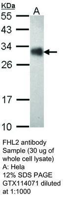 FHL2 antibody (aa 52-272), GeneTex