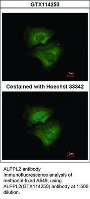 ALPPL2 antibody, GeneTex