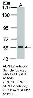 ALPPL2 antibody, GeneTex