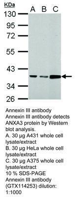 Annexin III antibody, GeneTex