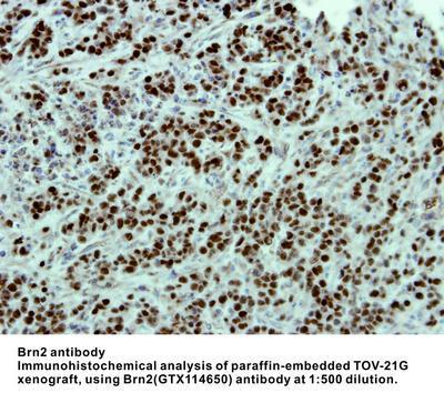 Brn2 antibody [C1C3], GeneTex