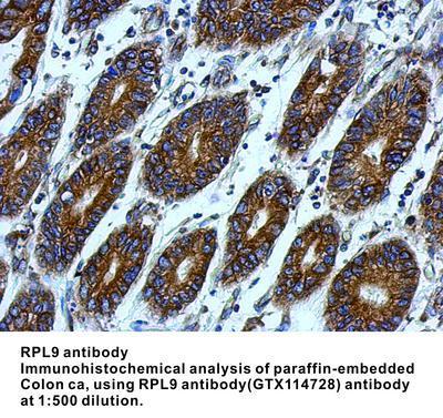 RPL9 antibody, GeneTex