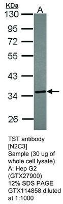 TST antibody [N2C3], GeneTex