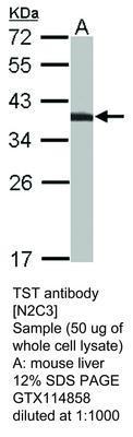 TST antibody [N2C3], GeneTex