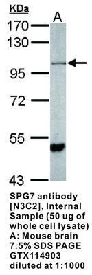 SPG7 antibody [N3C2], Internal, GeneTex