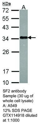 SF2 antibody, GeneTex