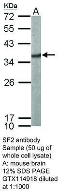 SF2 antibody, GeneTex