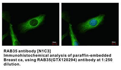 NDUFS2 antibody [N3C3], GeneTex