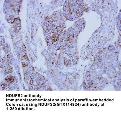 NDUFS2 antibody [N3C3], GeneTex