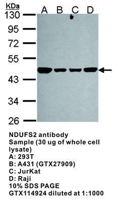 NDUFS2 antibody [N3C3], GeneTex