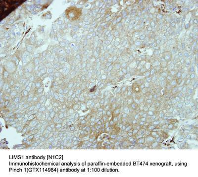 LIMS1 antibody [N1C2], GeneTex