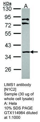 LIMS1 antibody [N1C2], GeneTex