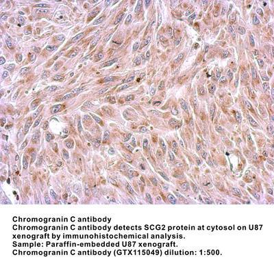 Chromogranin C antibody [N3C3], GeneTex