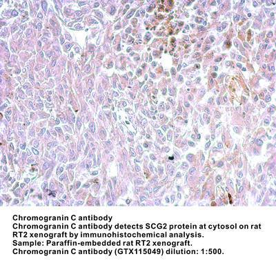 Chromogranin C antibody [N3C3], GeneTex