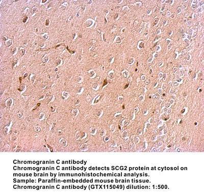 Chromogranin C antibody [N3C3], GeneTex