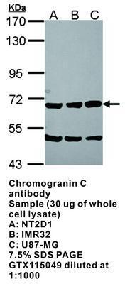 Chromogranin C antibody [N3C3], GeneTex