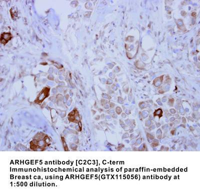 ARHGEF5 antibody [C2C3], C-term, GeneTex