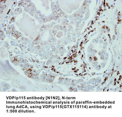 VDP/p115 antibody [N1N2], N-term, GeneTex