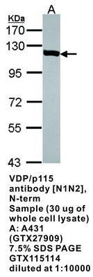 VDP/p115 antibody [N1N2], N-term, GeneTex