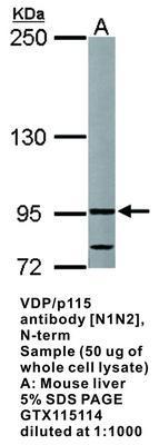 VDP/p115 antibody [N1N2], N-term, GeneTex