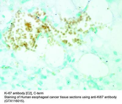 Ki-67   antibody [C2], C-term, GeneTex