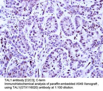 TAL1 antibody [C2C3], C-term, GeneTex