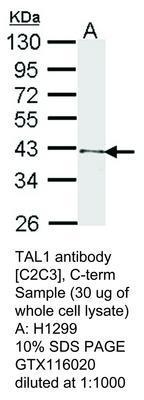 TAL1 antibody [C2C3], C-term, GeneTex