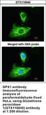 GPX1 antibody, GeneTex