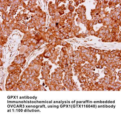 GPX1 antibody, GeneTex