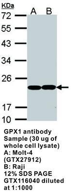 GPX1 antibody, GeneTex