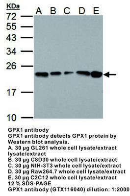 GPX1 antibody, GeneTex