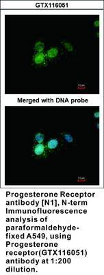 Progesterone Receptor antibody [N1], N-term, GeneTex