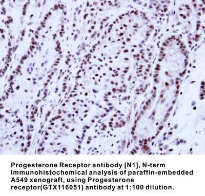 Progesterone Receptor antibody [N1], N-term, GeneTex