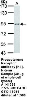 Progesterone Receptor antibody [N1], N-term, GeneTex