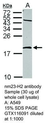 nm23-H2 antibody, GeneTex