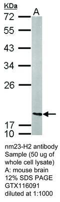 nm23-H2 antibody, GeneTex