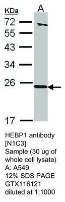 HEBP1 antibody [N1C3], GeneTex