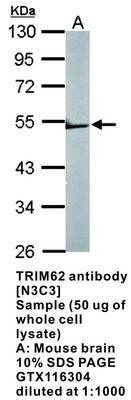 TRIM62 antibody [N3C3], GeneTex