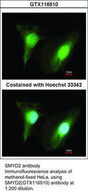 SMYD2 antibody, GeneTex