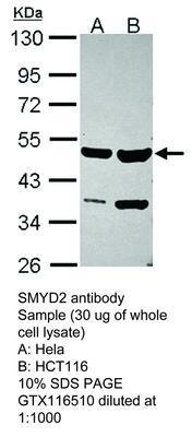 SMYD2 antibody, GeneTex