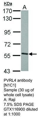 PVRL4 antibody [N1C1], GeneTex