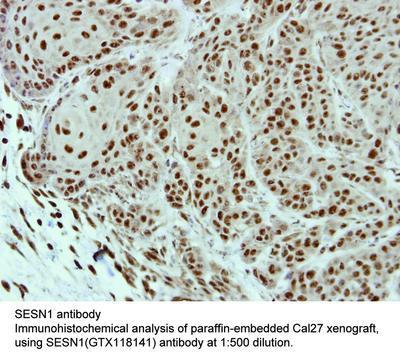 SESN1 antibody, GeneTex