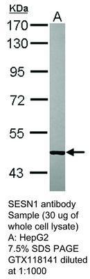 SESN1 antibody, GeneTex