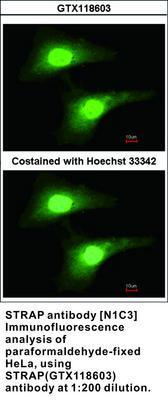 STRAP antibody [N1C3], GeneTex